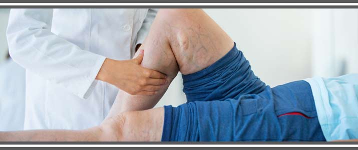 Patient with varicose veins being examined
